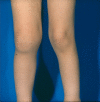 Fig. 2