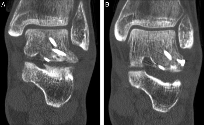 Figure 4