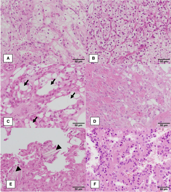 FIGURE 1