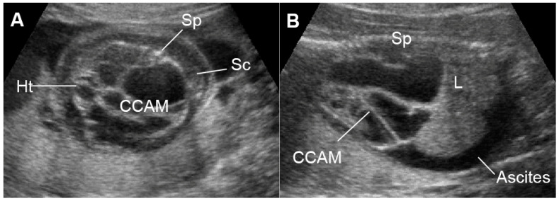 Figure 11