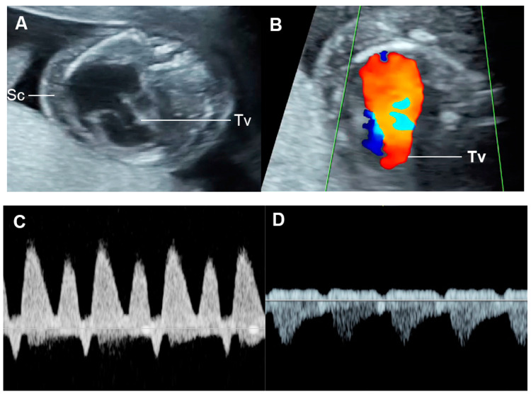 Figure 10