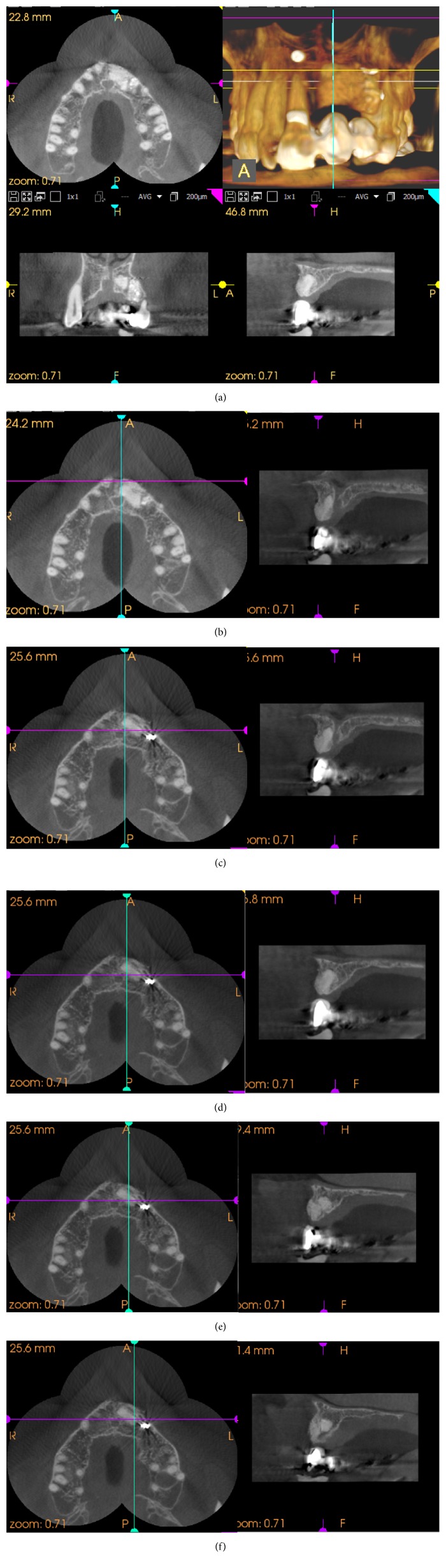 Figure 16