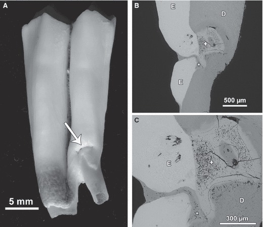 Fig. 11