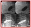 Figure 18
