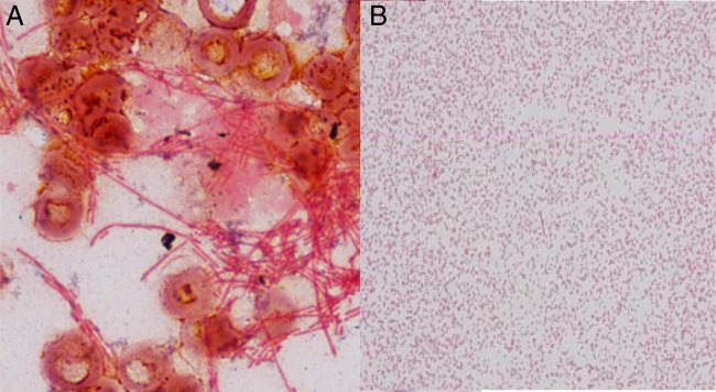 FIG 1