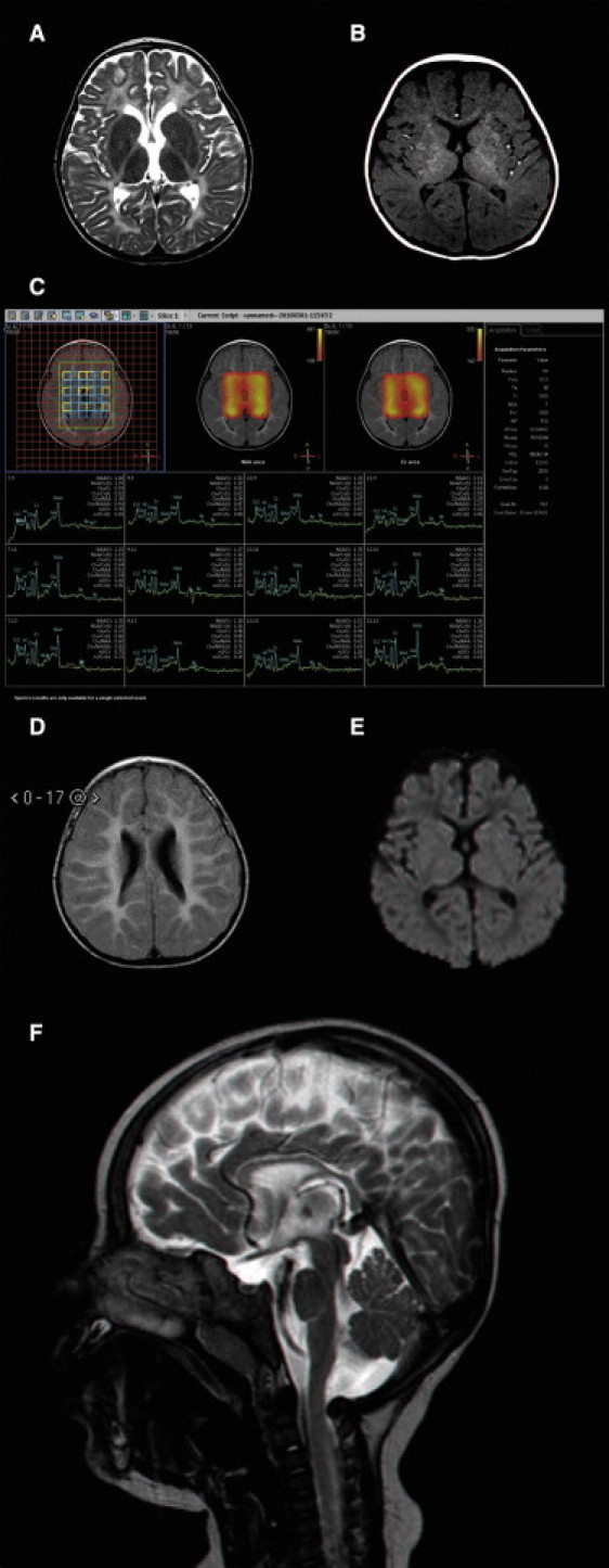 Figure 2