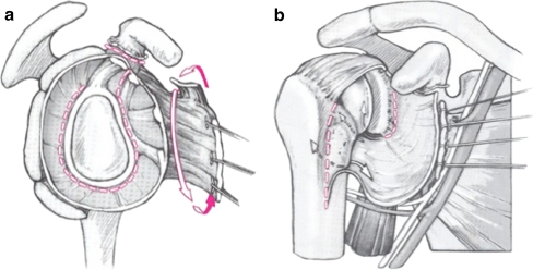 Fig. 3