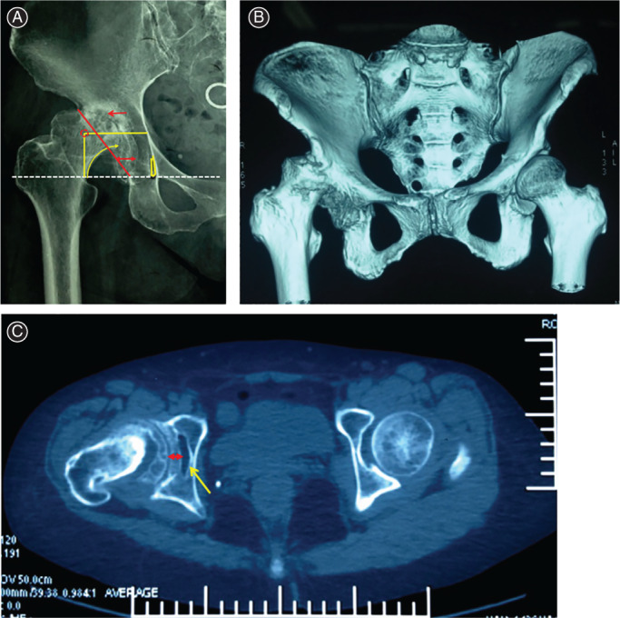 Fig. 1