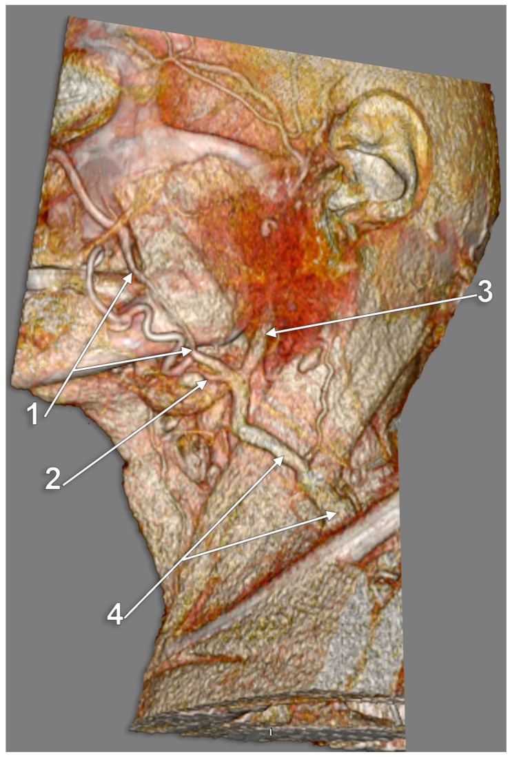 Figure 22