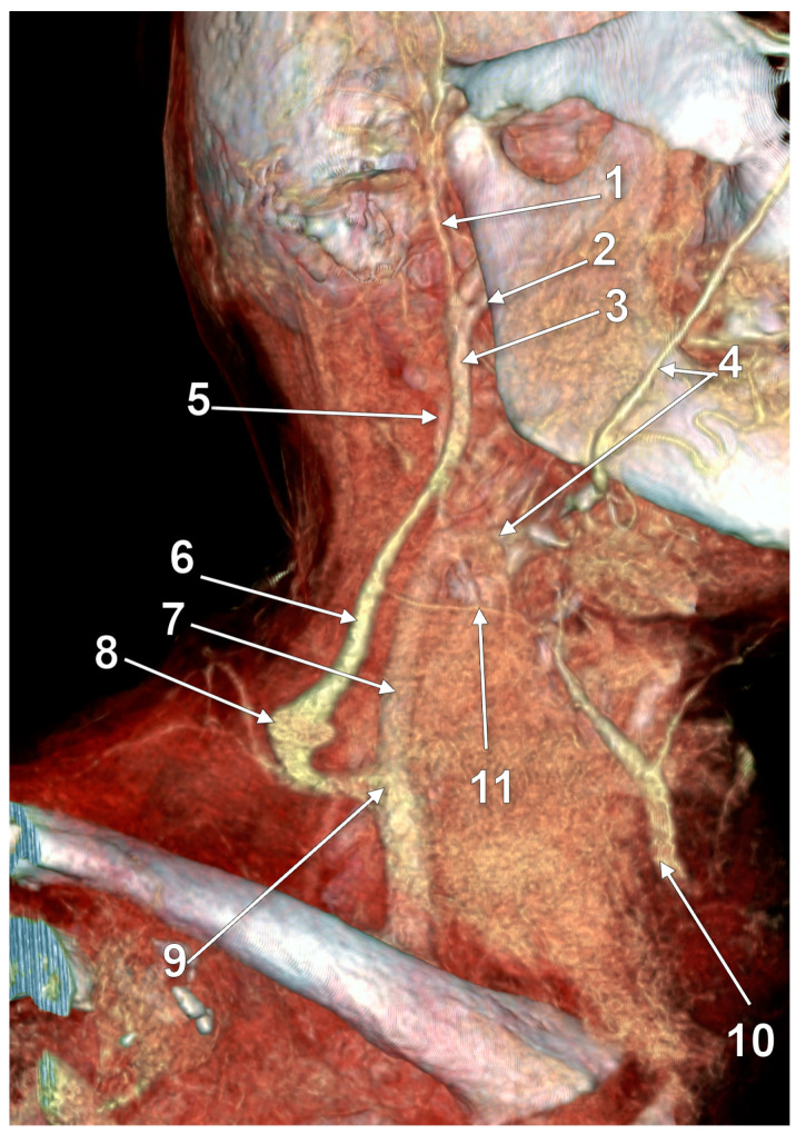 Anatomical Variations of the External Jugular Vein: A Pictorial and ...