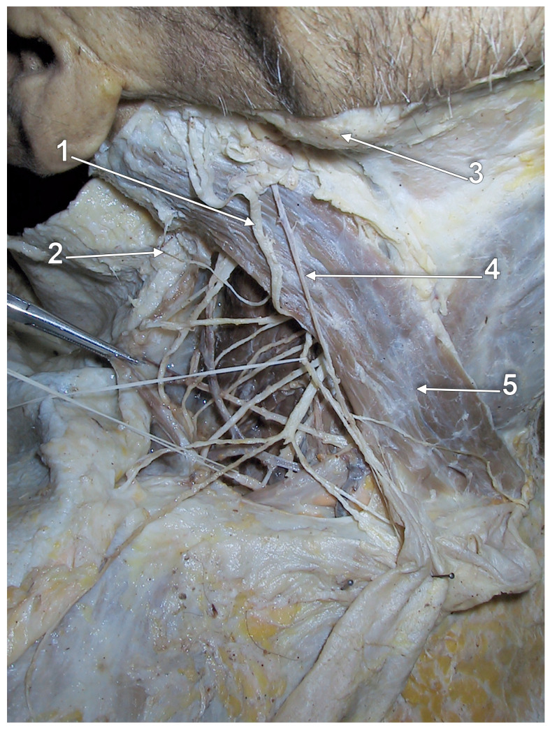 Figure 23