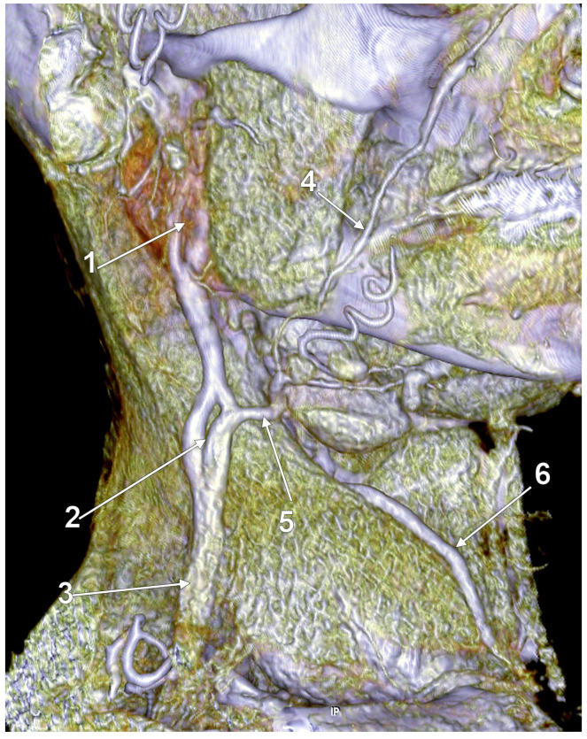 Figure 19