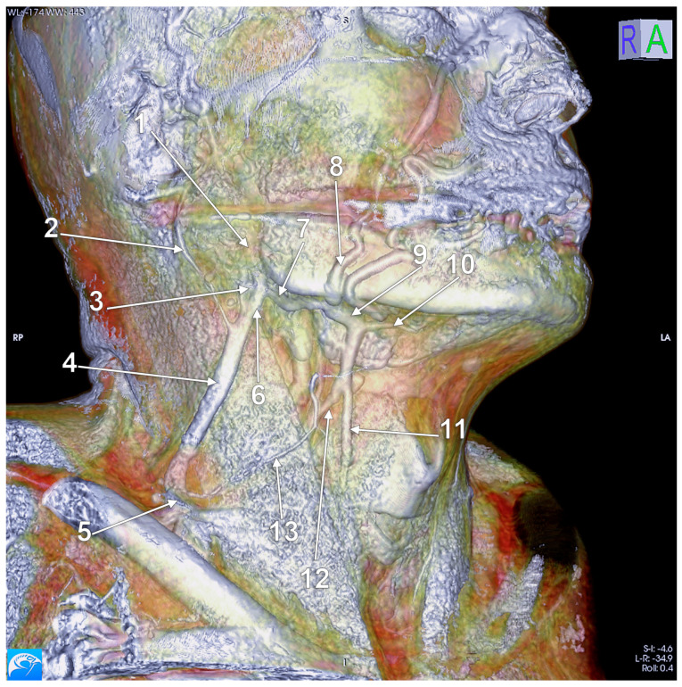 Figure 18