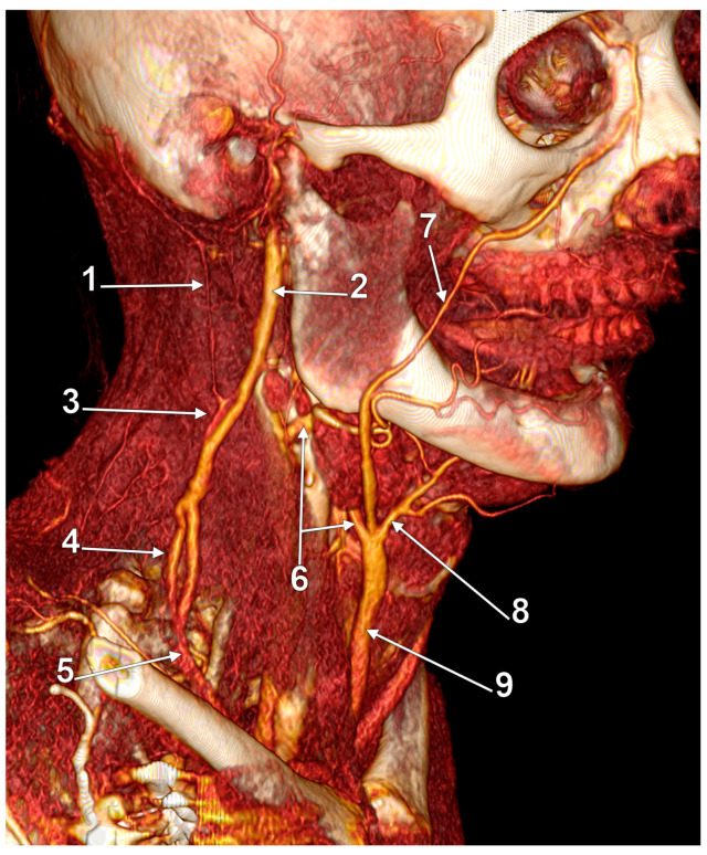 Figure 16