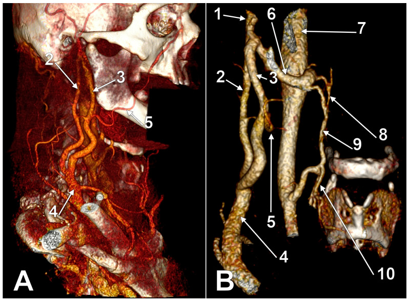 Figure 13