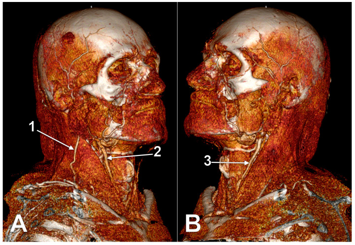 Figure 21