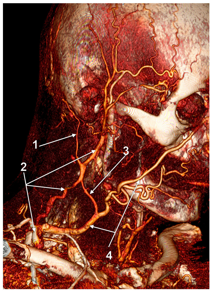 Figure 20