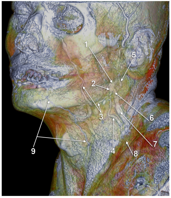 Figure 17