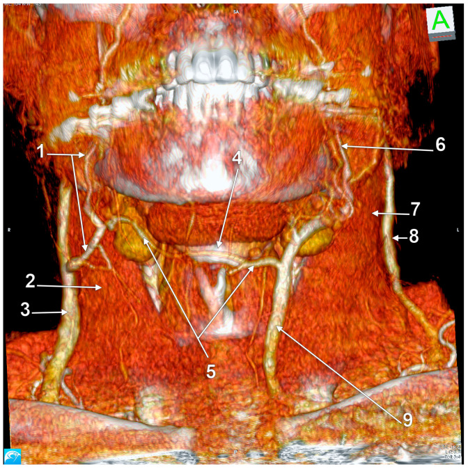 Anatomical Variations of the External Jugular Vein: A Pictorial and ...