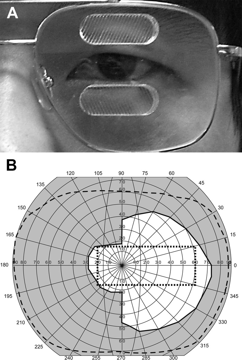 FIGURE 4