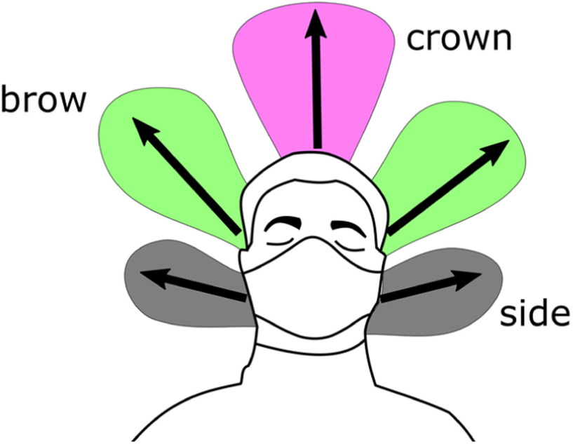 Figure 11.