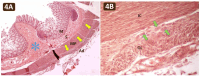 Fig. 4