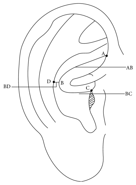 Figure 14