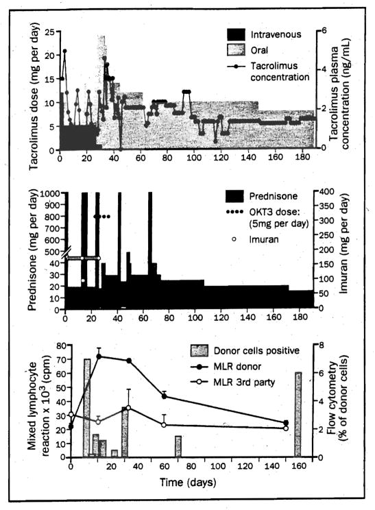 Figure 17