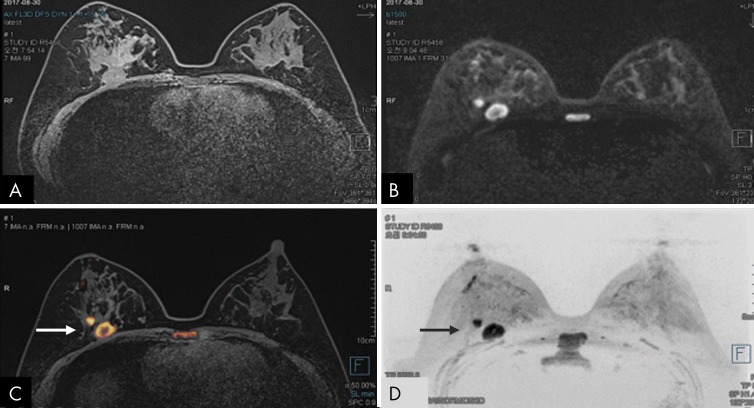 Figure 11: