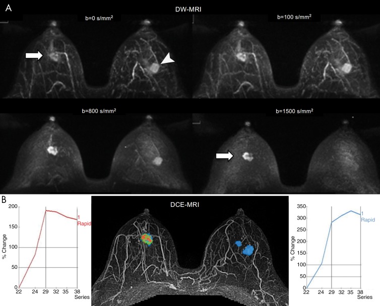 Figure 6: