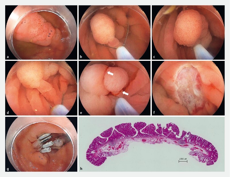 Fig. 2 