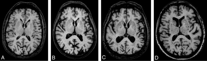 Fig 1.