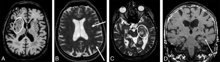 Fig 2.