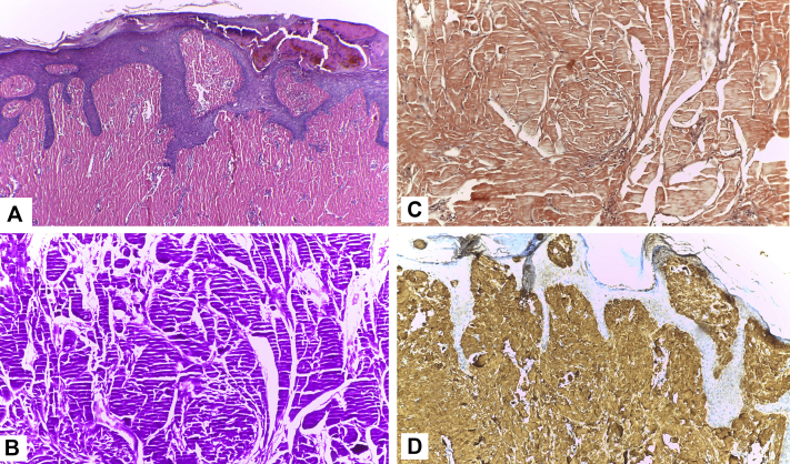 Fig 2