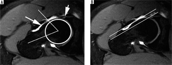 Figure 21