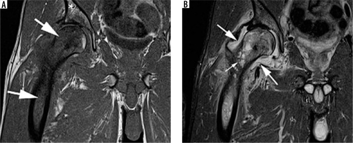 Figure 27