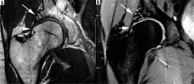 Figure 23