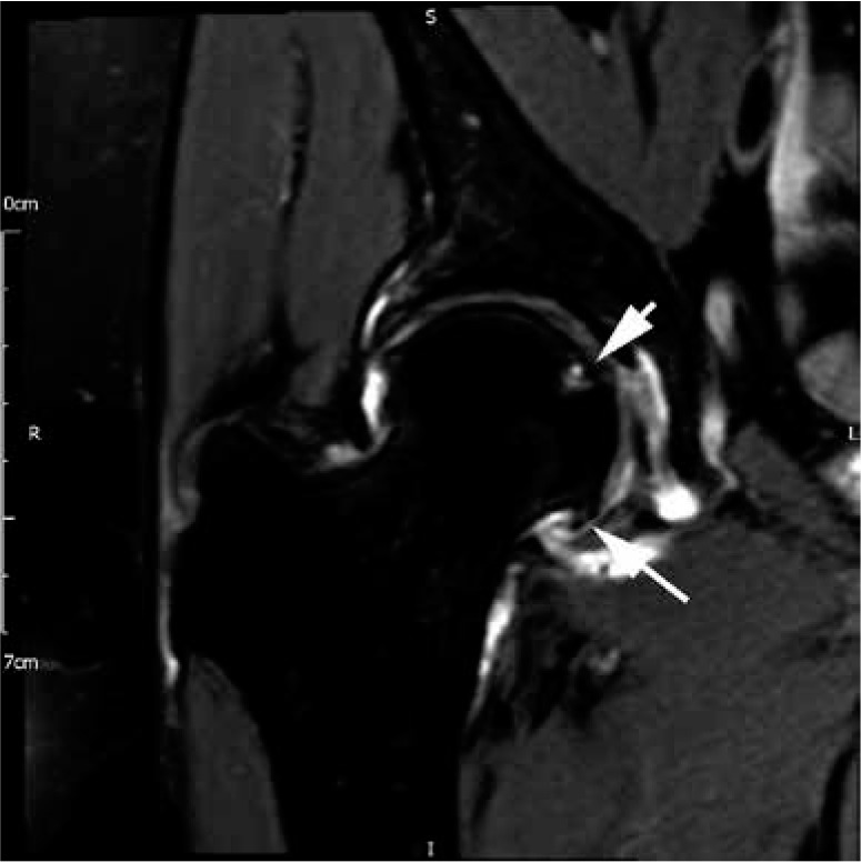 Figure 25