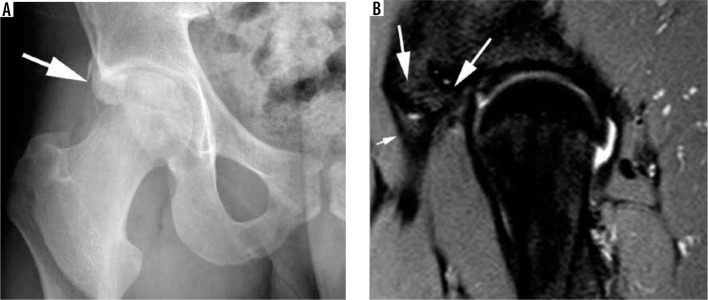 Figure 24