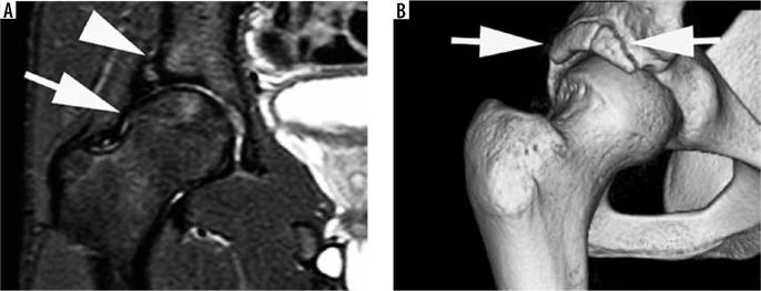 Figure 22