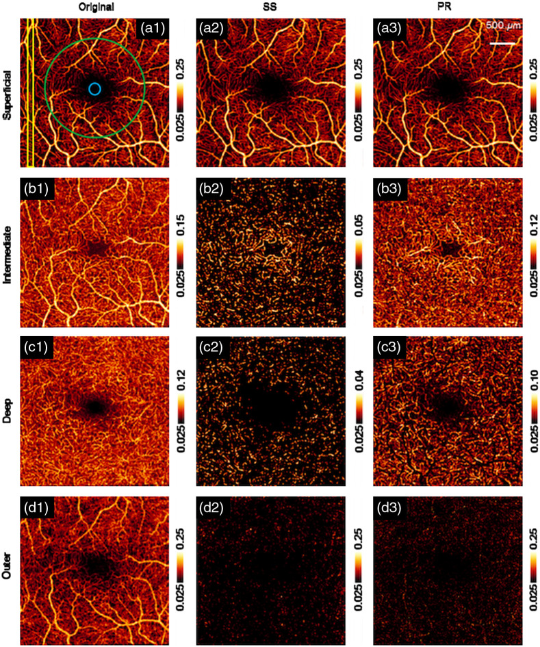 Fig. 10