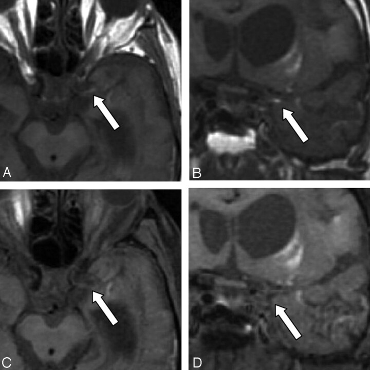 Fig 3.