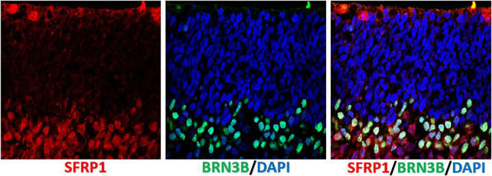 FIGURE 3