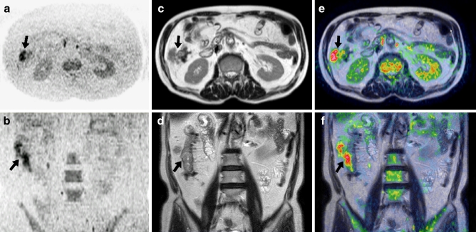 Fig. 12