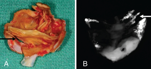 Figure 2)