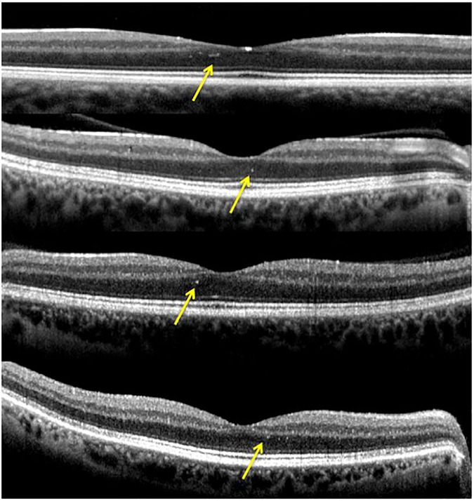 Fig 4