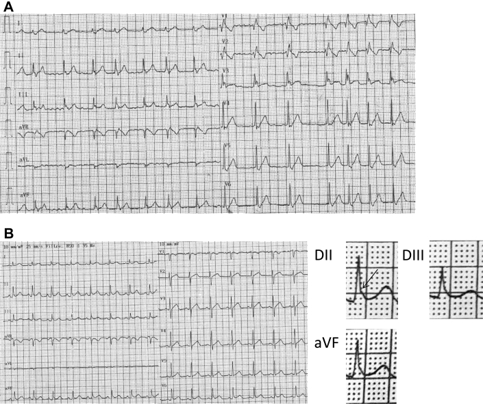 Figure 2