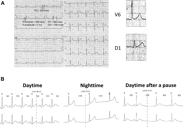 Figure 1