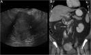 Fig. 12