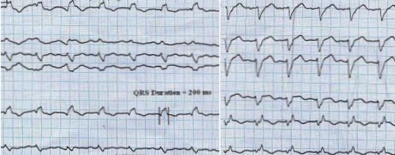 Figure 1A